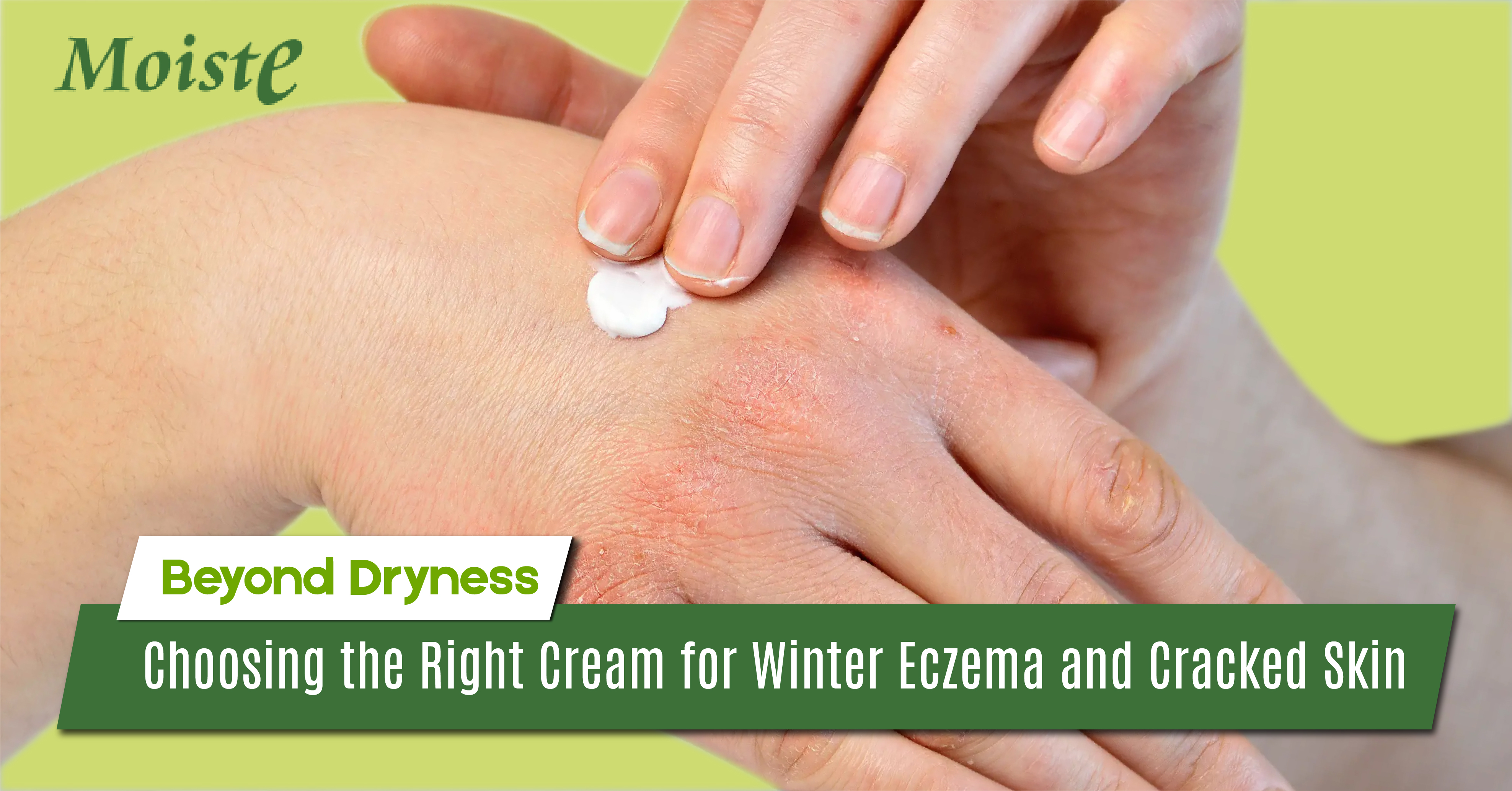 Beyond Dryness: Choosing the Right Cream for Winter Eczema and Cracked Skin 